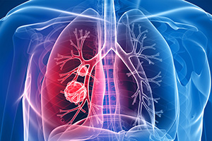 Pulmonology