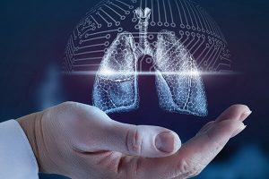 Thoracic Surgery