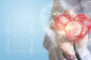 Cardiovascular Surgery